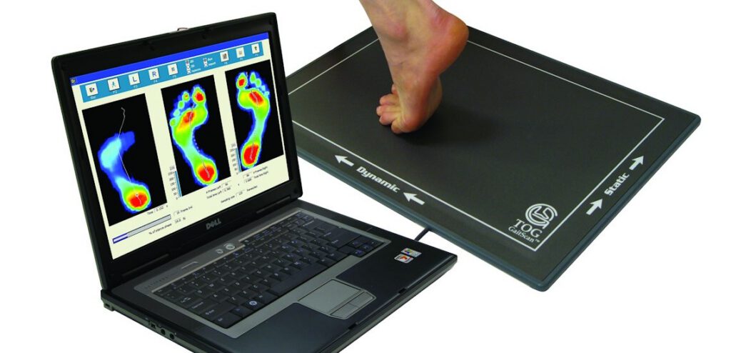 Gait Scan & Custom Orthotics in Etobicoke, Toronto